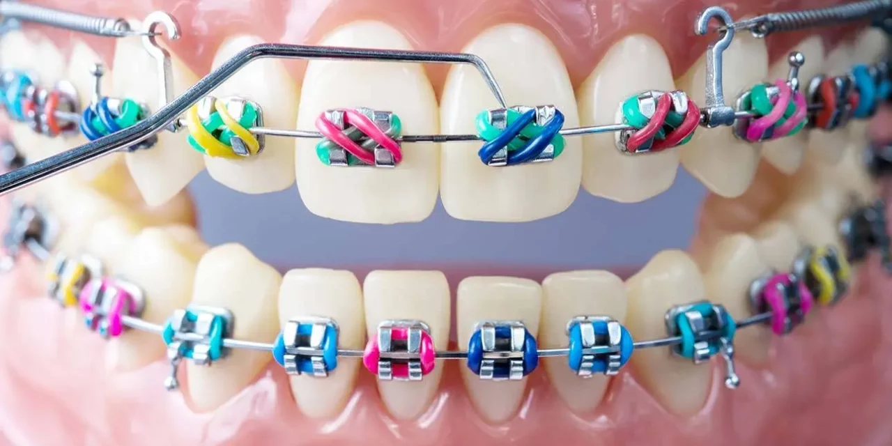 How orthodontics can improve your smile